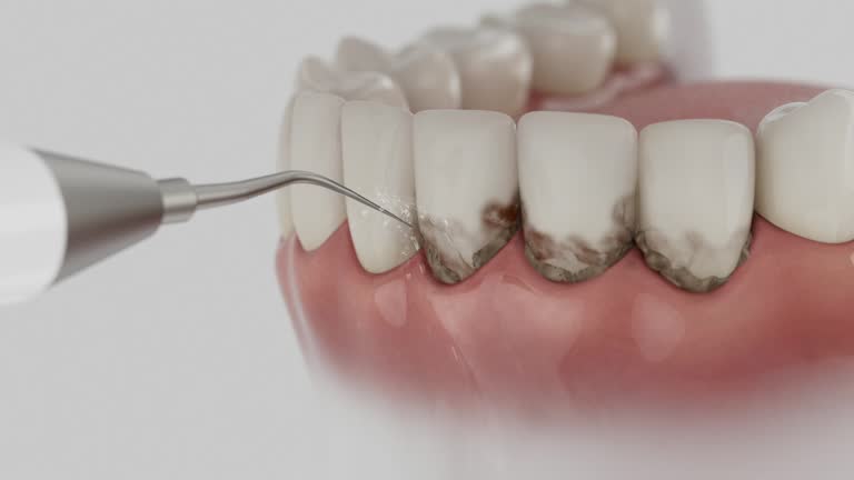 Reliable Wisdom Tooth Removal contractor in Frederick County County, MD by Dentist Open Now